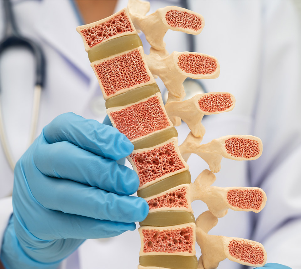 Curso Básico de Osteoporose &amp;#8211; 2ª edição